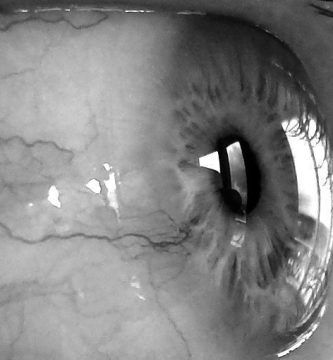 Ojos que aún siguen ahí, por Ariel F. Cambronero Zumbado