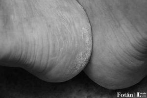 Fragmentos corporales, por Wilfredo Carrizales