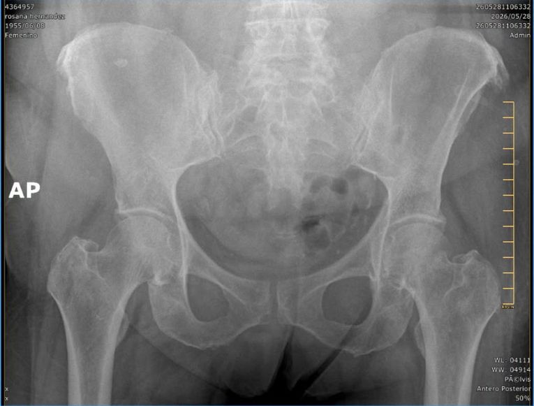 Radiografía de Rosana Hernández Pasquier